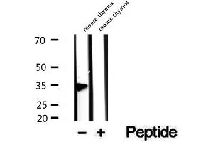 Western blot analysis of extracts of mouse thymus tissue, using PHF11 antibody. (PHF11 Antikörper  (C-Term))