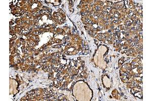 IHC analysis of IRBIT/AHCYL1 using anti-IRBIT/AHCYL1 antibody (ABIN7600030).