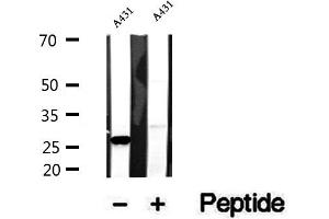Western blot analysis of extracts of A431 cells, using CHCHD3 antibody. (CHCHD3 Antikörper  (N-Term))