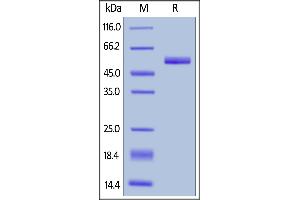 Human Prolactin, Mouse IgG2a Fc Tag, low endotoxin on  under reducing (R) condition.