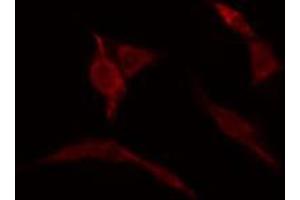 ABIN6274157 staining HuvEc cells by IF/ICC. (Homeobox C6 Antikörper  (N-Term))