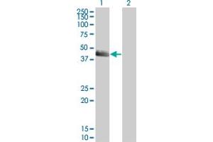 Western Blot analysis of SERPINE1 expression in transfected 293T cell line by SERPINE1 monoclonal antibody (M01), clone 3F2. (PAI1 Antikörper  (AA 86-185))
