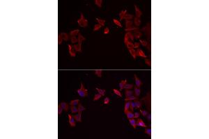 Immunofluorescence analysis of MCF-7 cells using RAMP3 antibody. (RAMP3 Antikörper)