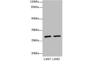 Western blot All lanes: APIPantibody at 1. (APIP Antikörper  (AA 1-242))