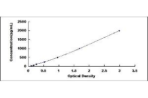 Typical standard curve (S100B ELISA Kit)