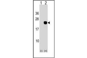 Western blot analysis of DCTD (arrow) using DCTD Antibody (N-term) Cat. (DCMP Deaminase (DCTD) (AA 1-30), (N-Term) Antikörper)