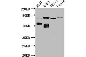 Western Blot Positive WB detected in: 293T whole cell lysate, K562 whole cell lysate, THP-1 whole cell lysate, Mouse Brain whole cell lysate All lanes: PKC antibody at 1:1000 Secondary Goat polyclonal to rabbit IgG at 1/50000 dilution Predicted band size: 82, 75, 68 kDa Observed band size: 82, 55 kDa (Rekombinanter PKC theta Antikörper)