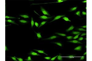 Immunofluorescence of purified MaxPab antibody to DGKZ on HeLa cell. (DGKZ Antikörper  (AA 1-929))