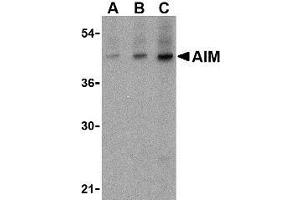 Western blot analysis of AIM in human lymph node tissue lysate with AP30035PU-N AIM antibody at (A) 1, (B) 2 and (C) 4 μg/ml. (CD5L Antikörper  (N-Term))
