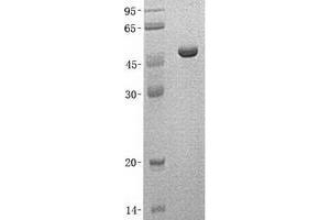 Validation with Western Blot (NADK Protein (Transcript Variant 3) (His tag))