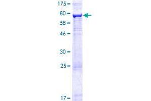 Image no. 1 for Arrestin Domain Containing 1 (ARRDC1) (AA 1-433) protein (GST tag) (ABIN1345730) (ARRDC1 Protein (AA 1-433) (GST tag))