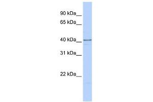 HNRPDL antibody used at 1 ug/ml to detect target protein. (HNRPDL Antikörper  (C-Term))