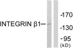 Western blot analysis of extracts from Jurkat cells, using Integrin beta1 (Ab-789) Antibody. (ITGB1 Antikörper  (AA 746-795))
