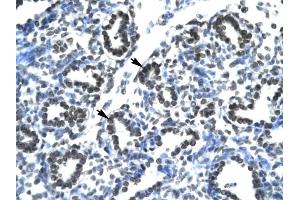 Claudin 17 antibody was used for immunohistochemistry at a concentration of 4-8 ug/ml to stain Alveolar cells (arrows) in Human Lung. (Claudin 17 Antikörper  (Middle Region))