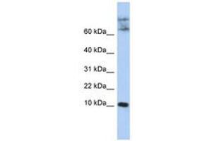 Image no. 1 for anti-Chemokine-Like Factor (CKLF) (N-Term) antibody (ABIN6741007) (CKLF Antikörper  (N-Term))