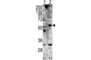 Western blot analysis of STK11 (arrow) using rabbit polyclonal STK11 Antibody . (LKB1 Antikörper  (N-Term))