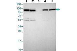 Western blot analysis of ZC3HAV1 polyclonal antibody .