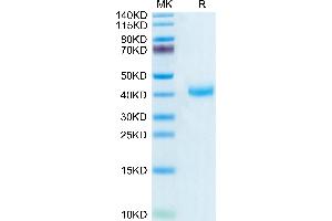 CD161 Protein (AA 67-225) (His-Avi Tag,Biotin)