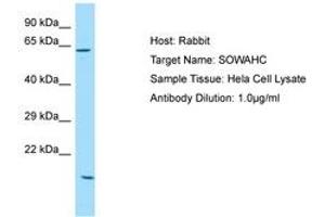 Image no. 1 for anti-Ankyrin Repeat Domain 57 (ANKRD57) (AA 425-474) antibody (ABIN6750152) (ANKRD57 Antikörper  (AA 425-474))