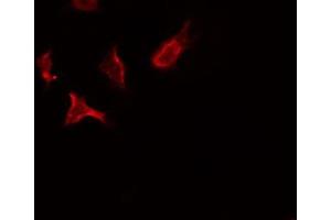 ABIN6275847 staining HeLa by IF/ICC. (STK10-A Antikörper  (Internal Region))