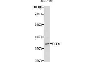Western blot analysis of extracts of U-251MG cells, using GPR6 antibody.