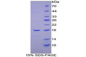 SDS-PAGE analysis of Human Hemoglobin Mu Protein. (Hemoglobin, mu Protein)