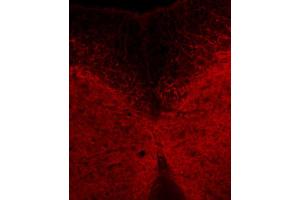 Immunohistochemistry (IHC) image for anti-Nicotinic Acetylcholine Receptor beta (CHRNB1) antibody (ABIN1742452) (CHRNB1 Antikörper)