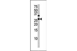 Image no. 1 for anti-Cyclin-Dependent Kinase Inhibitor 1B (p27, Kip1) (CDKN1B) (pThr187) antibody (ABIN358186) (CDKN1B Antikörper  (pThr187))