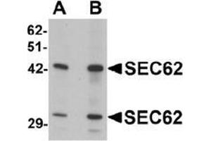 Western blot analysis of SEC62 in rat brain tissue lysate with SEC62 antibody at (A) 0. (SEC62 Antikörper  (C-Term))