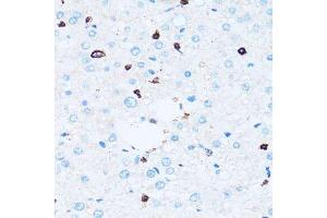Immunohistochemistry (Paraffin-embedded Sections) (IHC (p)) image for anti-Sialophorin (SPN) (AA 276-400) antibody (ABIN6148363)