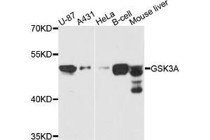 Western blot analysis of extracts of various cell lines, using GSK3A antibody (ABIN5970240) at 1/1000 dilution. (GSK3 alpha Antikörper)