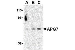 Western Blotting (WB) image for anti-ATG7 Autophagy Related 7 (ATG7) (C-Term) antibody (ABIN2477539) (ATG7 Antikörper  (C-Term))