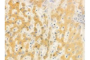 ABIN6262446 and ABIN6278479 at 1/100 staining human normal liver tissue by IHC-P. (IDH3B Antikörper  (N-Term))