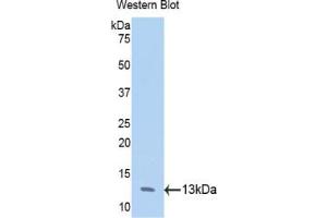 Western blot analysis of the recombinant protein. (Annexin IV Antikörper  (AA 165-260))
