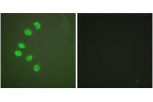 Immunofluorescence analysis of A549 cells, using Progesterone Receptor (Ab-294) Antibody. (Progesterone Receptor Antikörper  (AA 261-310))