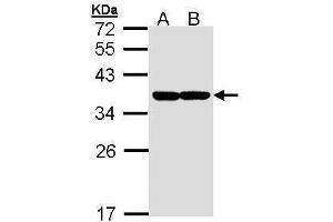 WB Image Sample (30 ug of whole cell lysate) A: Molt-4 , B: Raji 12% SDS PAGE antibody diluted at 1:1000 (XBP1 Antikörper)