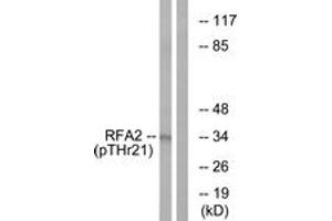 Western blot analysis of extracts from HeLa cells treated with Adriamycin 0. (RPA2 Antikörper  (pThr21))