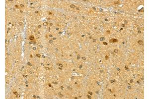 ABIN6265848 and ABIN6277175 at 1/100 staining Rat brain tissue by IHC-P.