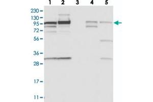 Western blot analysis of Lane 1: RT-4, Lane 2: U-251 MG, Lane 3: Human Plasma, Lane 4: Liver, Lane 5: Tonsil with SCARF2 polyclonal antibody  at 1:250-1:500 dilution. (SCARF2 Antikörper)