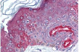 Human Skin (formalin-fixed, paraffin-embedded) stained with FAM3C antibody ABIN293839 at 5-10 ug/ml followed by biotinylated goat anti-rabbit IgG secondary antibody ABIN481713, alkaline phosphatase-streptavidin and chromogen. (FAM3C Antikörper  (AA 40-80))