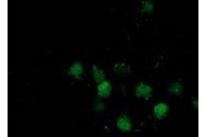 Immunofluorescence (IF) image for anti-Destrin (Actin Depolymerizing Factor) (DSTN) antibody (ABIN1497909) (Destrin Antikörper)