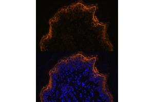 Immunofluorescence analysis of rat skin using SPRR1A antibody (ABIN7270369) at dilution of 1:100. (SPRR1A Antikörper)