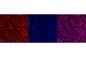 Immunohistochemistry (IHC) image for anti-ISL LIM Homeobox 1 (ISL1) antibody (ABIN7456087) (ISL1 Antikörper)