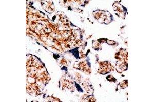 Immunohistochemistry (IHC) image for anti-Transforming Growth Factor, beta Receptor III (TGFBR3) (C-Term) antibody (ABIN7304586)