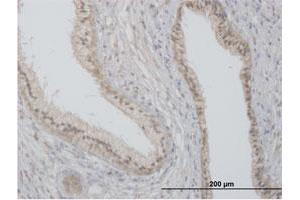 Immunohistochemistry (Formalin-fixed Paraffin-embedded Sections) (IHC (fp)) image for anti-Flotillin 2 (FLOT2) (AA 1-379) antibody (ABIN515754)