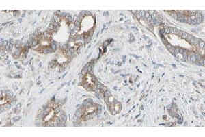 ABIN6276516 at 1/100 staining Human prostate tissue by IHC-P. (ARHGEF7 Antikörper  (Internal Region))