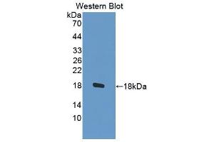Western blot analysis of the recombinant protein. (STAT5A Antikörper  (AA 673-773))