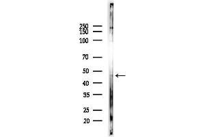anti-Ferrochelatase (FECH) (C-Term) antibody