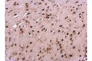 Immunohistochemistry (IHC) image for anti-Von Hippel-Lindau Tumor Suppressor, E3 Ubiquitin Protein Ligase (VHL) antibody (ABIN2854928)