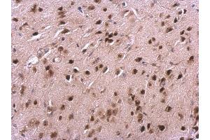 IHC-P Image VHL antibody detects VHL protein at cytosol and nucleus on mouse fore brain by immunohistochemical analysis. (VHL Antikörper)